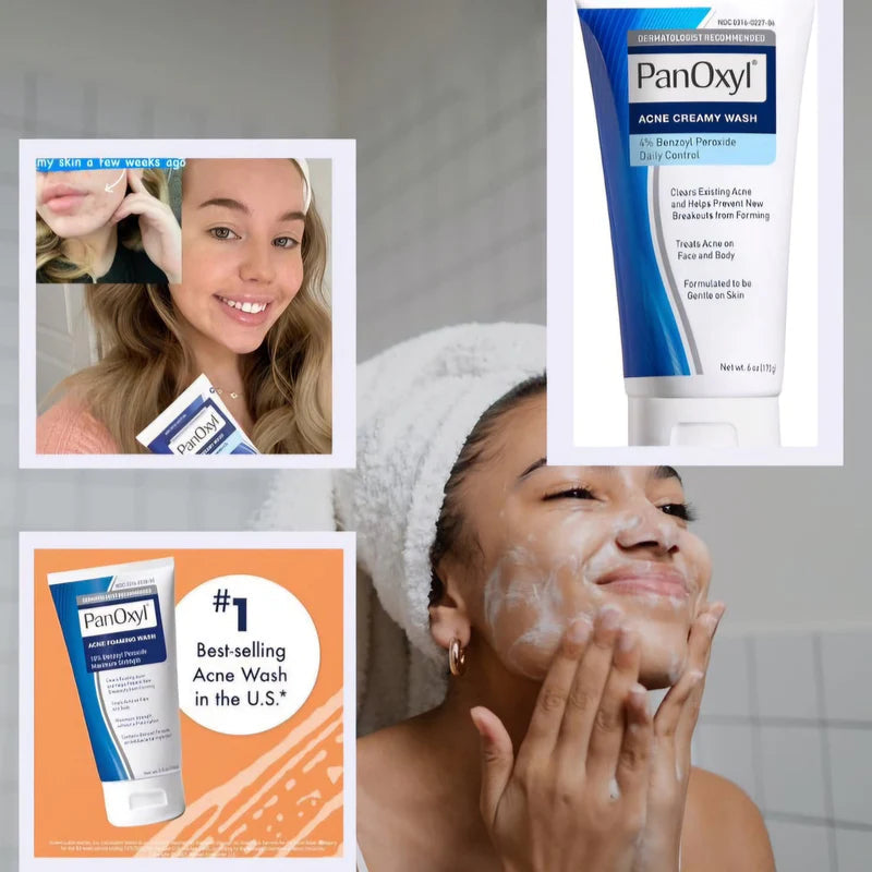 PanOxyl Acne Creamy Wash
