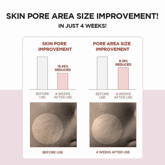 Skin1004 Madagascar - Centella Poremizing Clear Toner